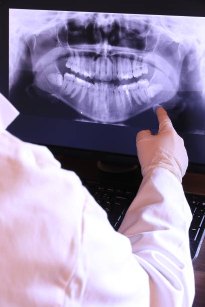 Best Emergency Dental Care for Broken or Chipped Teeth in Coon Rapids, MN